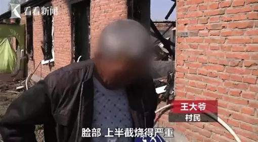 衝火海救92歲母!孝女全身燒焦命危