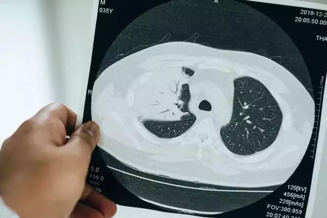 36歲癌症奶爸,生命最後3年為兒子留下「愛的禮物」,感動無數人