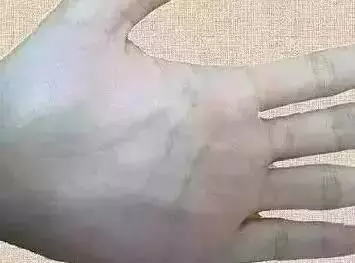 手上青筋越多,說明越……尤其是女性一定要看!
