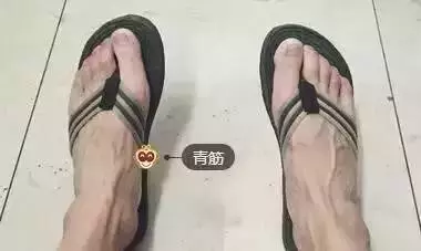 手上青筋越多,說明越……尤其是女性一定要看!