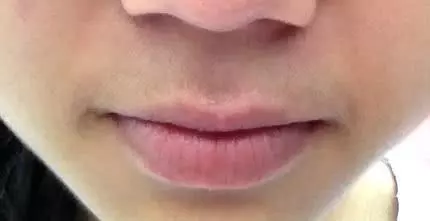 為什麼有的女性嘴邊會長出「小鬍子」?可以經常刮嗎?告訴你答案