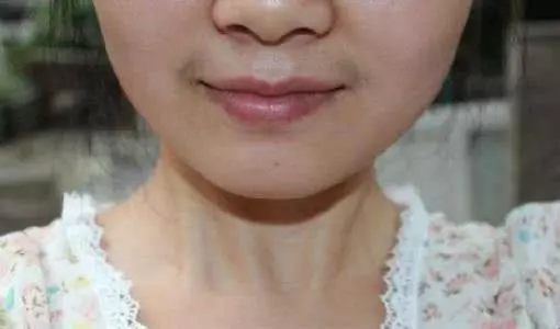 為什麼有的女性嘴邊會長出「小鬍子」?可以經常刮嗎?告訴你答案