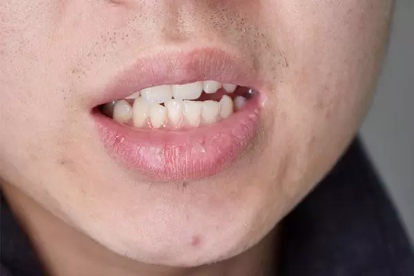 牙縫裡的黃泥又臭又硬,如何緩解?教你刷牙妙招,牙齒潔白又清新