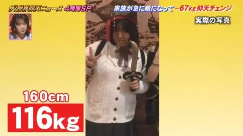 18歲少女「坐爆椅子」秒開始減肥 從「116公斤→49公斤」網認不出來:好正!