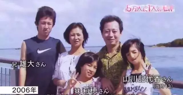 日本面部缺陷的無臉妹,被嘲笑為「怪物」,卻依然活得堅定溫柔!