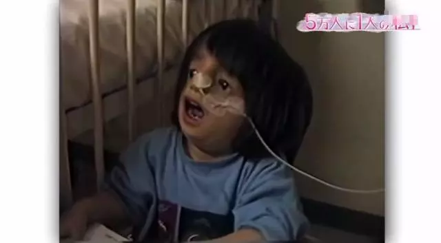 日本面部缺陷的無臉妹,被嘲笑為「怪物」,卻依然活得堅定溫柔!