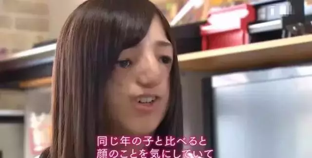 日本面部缺陷的無臉妹,被嘲笑為「怪物」,卻依然活得堅定溫柔!