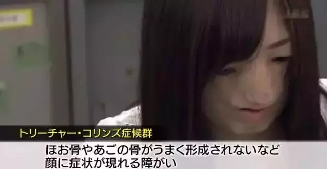 日本面部缺陷的無臉妹,被嘲笑為「怪物」,卻依然活得堅定溫柔!