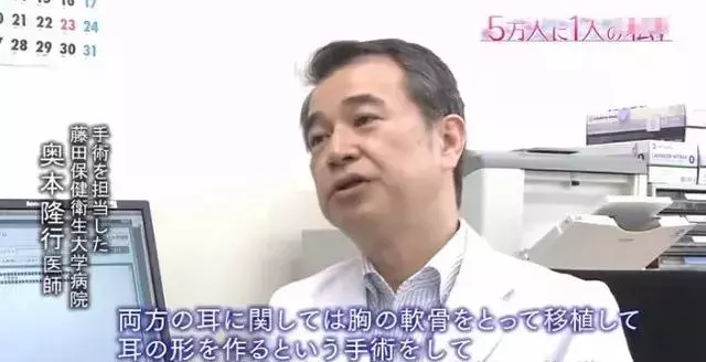 日本面部缺陷的無臉妹,被嘲笑為「怪物」,卻依然活得堅定溫柔!