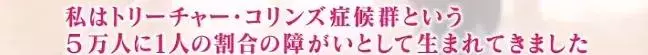 日本面部缺陷的無臉妹,被嘲笑為「怪物」,卻依然活得堅定溫柔!