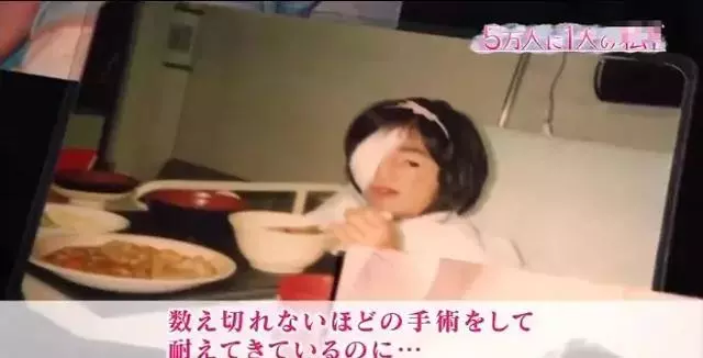 日本面部缺陷的無臉妹,被嘲笑為「怪物」,卻依然活得堅定溫柔!