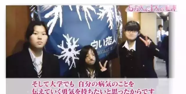日本面部缺陷的無臉妹,被嘲笑為「怪物」,卻依然活得堅定溫柔!