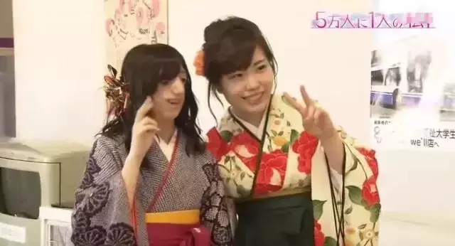 日本面部缺陷的無臉妹,被嘲笑為「怪物」,卻依然活得堅定溫柔!