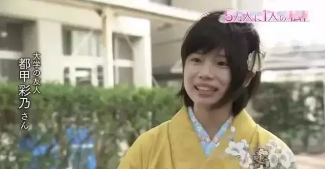日本面部缺陷的無臉妹,被嘲笑為「怪物」,卻依然活得堅定溫柔!