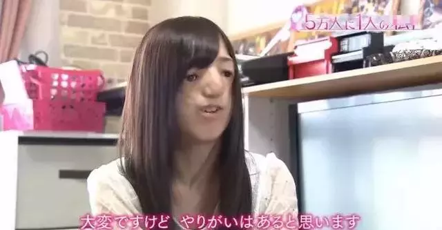 日本面部缺陷的無臉妹,被嘲笑為「怪物」,卻依然活得堅定溫柔!
