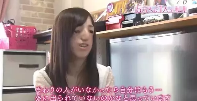 日本面部缺陷的無臉妹,被嘲笑為「怪物」,卻依然活得堅定溫柔!