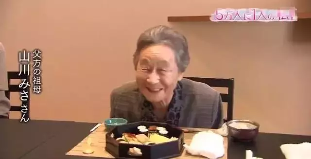 日本面部缺陷的無臉妹,被嘲笑為「怪物」,卻依然活得堅定溫柔!