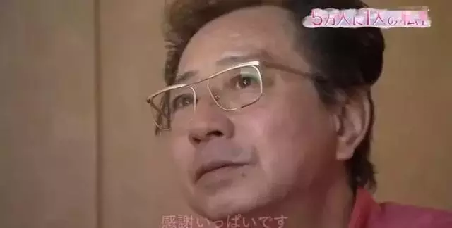 日本面部缺陷的無臉妹,被嘲笑為「怪物」,卻依然活得堅定溫柔!