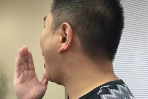 口臭的人為何自己聞不到?口臭是什麼引起的?