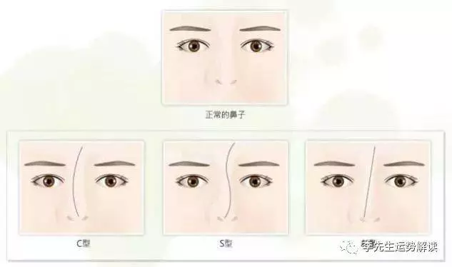 面相看鼻子,鼻子歪的面相好不好 !