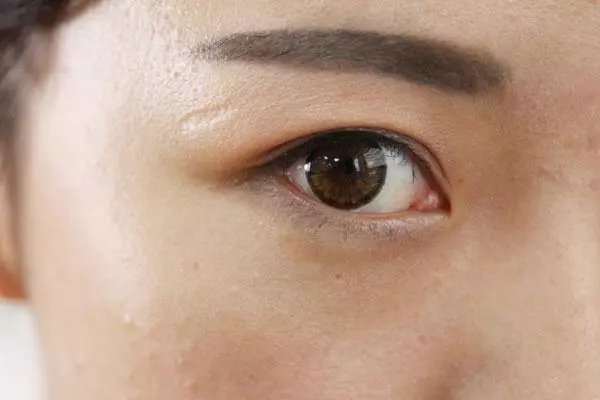 眼睛疲勞危害多,教你正確按摩方法,緩解疲勞,讓眼睛更健康