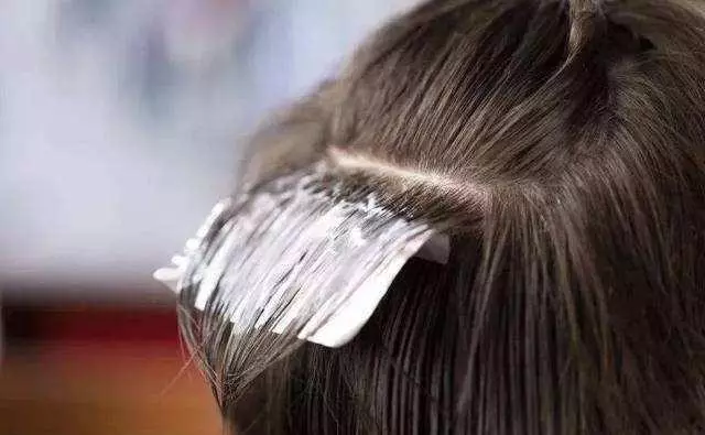 洗頭髮加醋、生薑可以去頭屑?別相信偏方,真正需要做的是3件事