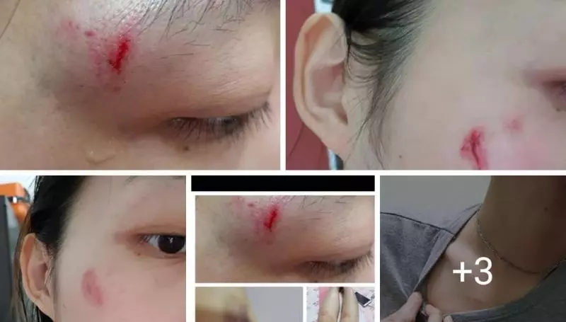 「明知我情緒不穩會自我傷害仍不斷追求,還在一星期內就登記」,女子控訴渣男「說好情不變卻做不到」
