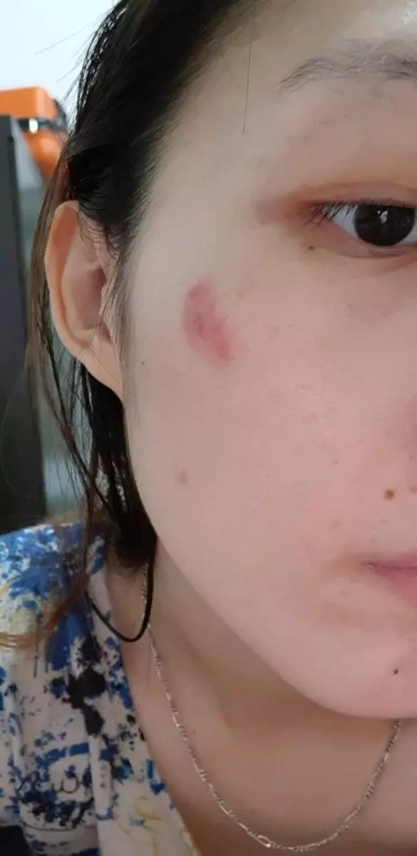 「明知我情緒不穩會自我傷害仍不斷追求,還在一星期內就登記」,女子控訴渣男「說好情不變卻做不到」