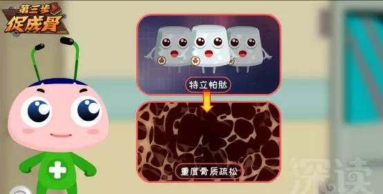老年人骨質疏鬆,應該注意些什麼?