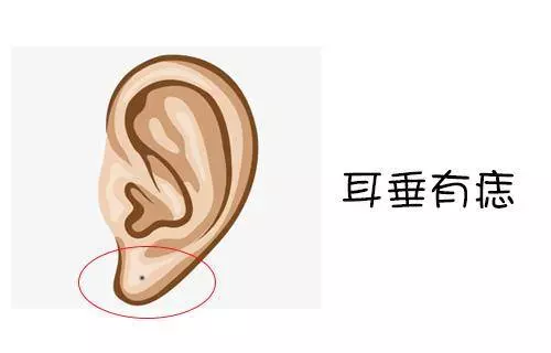 身上這3處有痣的人,富貴加身,一生錦衣玉食 !