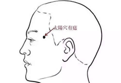 這幾個部位長痣的人,賺錢能力超強!