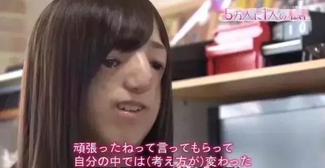 日本面部缺陷的無臉妹,被嘲笑為「怪物」,卻依然活得堅定溫柔