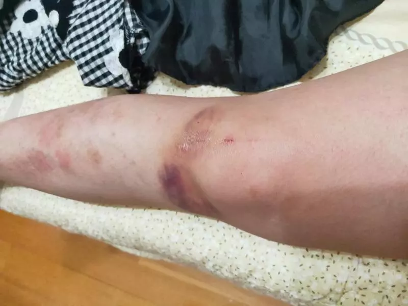 狗狗肉前搖臂無碰撞斷裂,原廠回應『車倒次數太多造成』! 車主無奈「你是認命了,還是想要訓練EQ」
