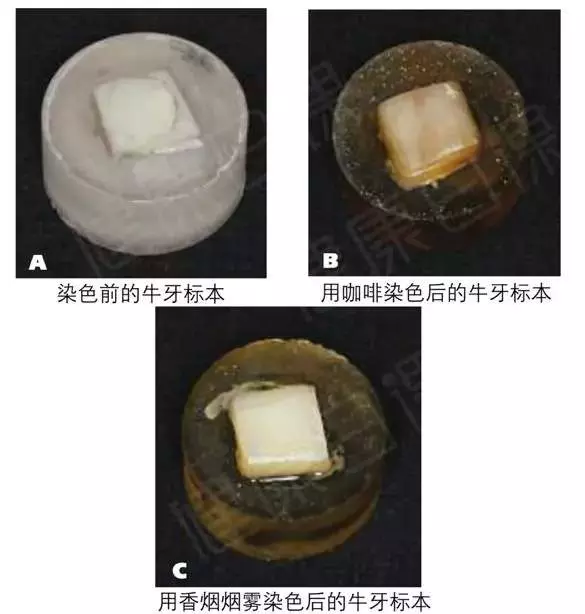 花草茶、咖啡、運動飲料,比紅茶香菸可樂更傷牙齒!