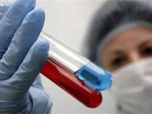 高尿酸患者注意:家裡3種食物一口也不能多吃,尿酸飆升很快 !