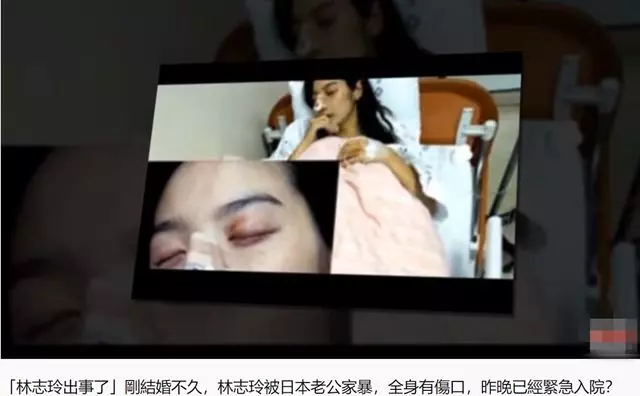 林志玲遭日本老公家暴?毒打全身,緊急入院?做試管嬰兒、500萬元陪喝酒,難怪老公無情!