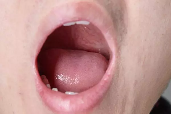 刷牙的時候,經常出血疼痛是為啥?如何刷牙才更健康?