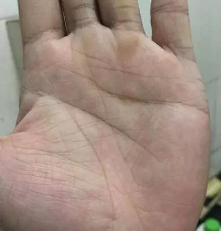 大拇指上有這種符號的人,非常善於經營投資,早晚成富豪!