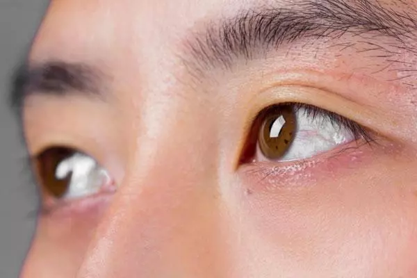 眼皮跳是不好的徵兆?眼皮跳貼白紙有用嗎?一文告訴你答案