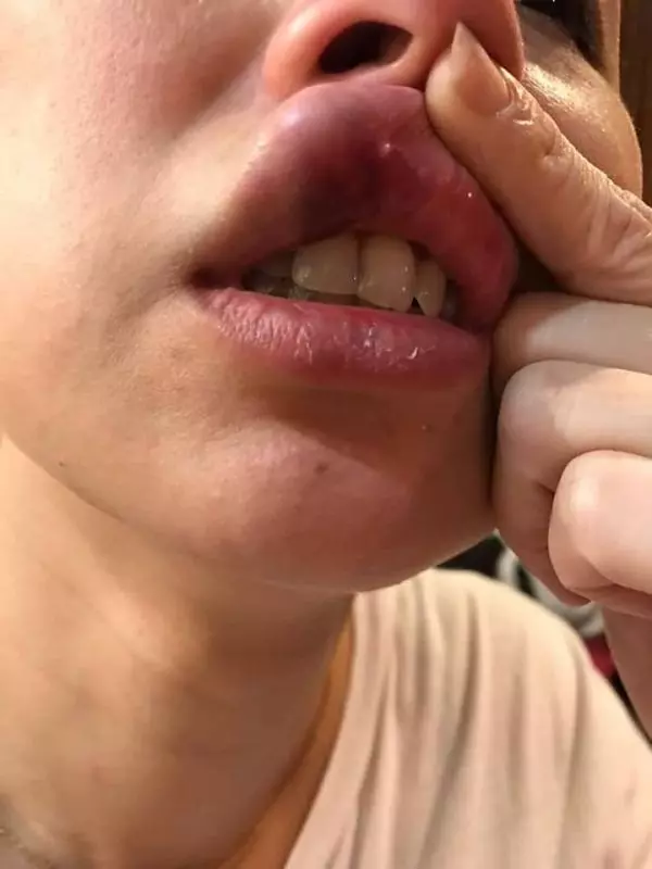 大馬著名跌打師傅Chris Leong「出事了」,老婆震怒開炮!跟家人爭吵還動手!