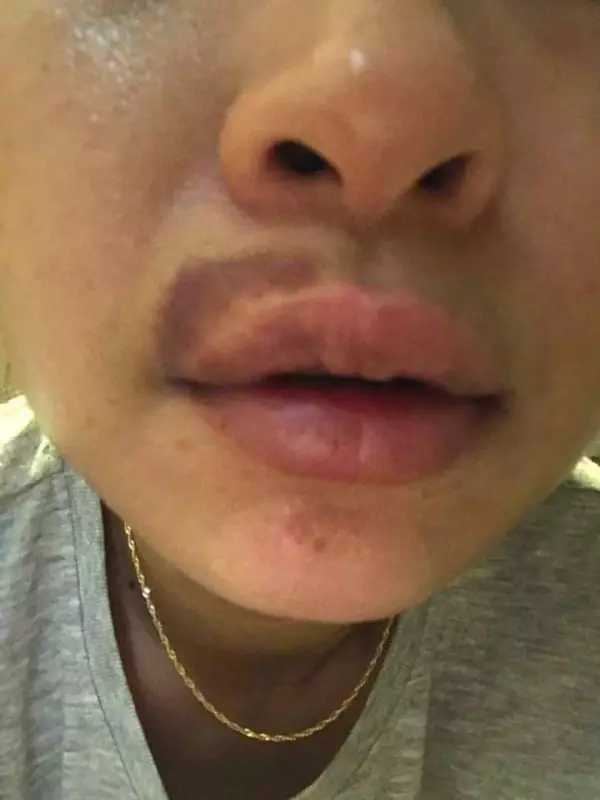 大馬著名跌打師傅Chris Leong「出事了」,老婆震怒開炮!跟家人爭吵還動手!