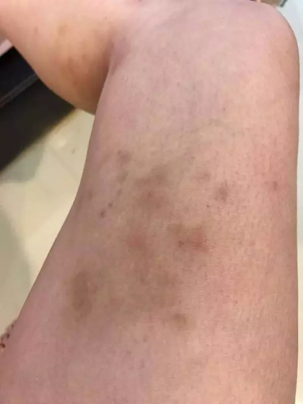 大馬著名跌打師傅Chris Leong「出事了」,老婆震怒開炮!跟家人爭吵還動手!