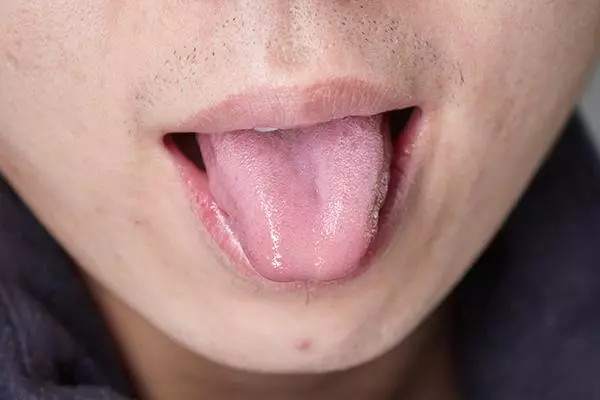 心臟不好,舌頭先知?舌頭再三發出的「信號」,或暗示心已傷