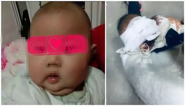 阿嬤牽他到鄰居家 1歲童被狗咬掉半邊臉