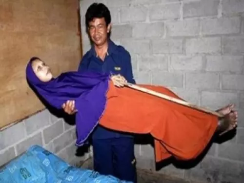 35歲婦女染上可怕怪病,10年來身體硬梆梆無法彎腰,成了當地聞名的「殭屍女」!