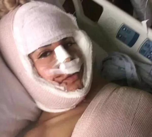 35歲女子花重金整容,一年經歷13次整容手術!沒想到遭網友吐槽:「沒整還比較漂亮!」