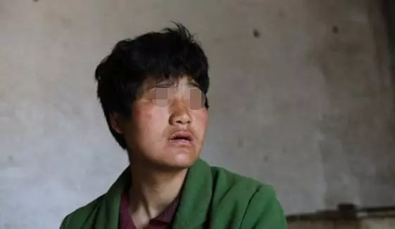 姐姐為弟弟買房,三年後姐姐患病,弟弟拿二百:就這些,愛要不要