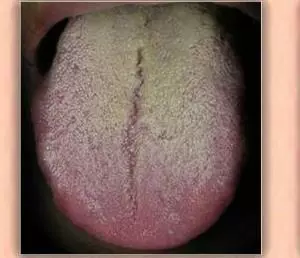 膚色暗沉、氣色差?說到底還是「氣血不足」!一劑小方4味藥搞定!