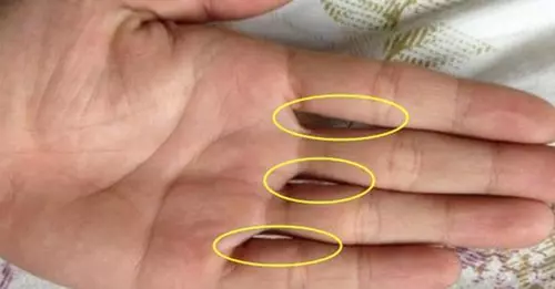 當你五指併攏時,有幾個洞?