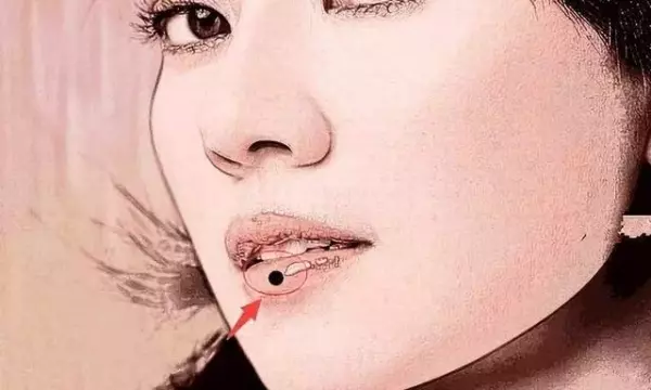 面相分析:臉上有5顆痣不能留!一生坎坷,男女皆準!